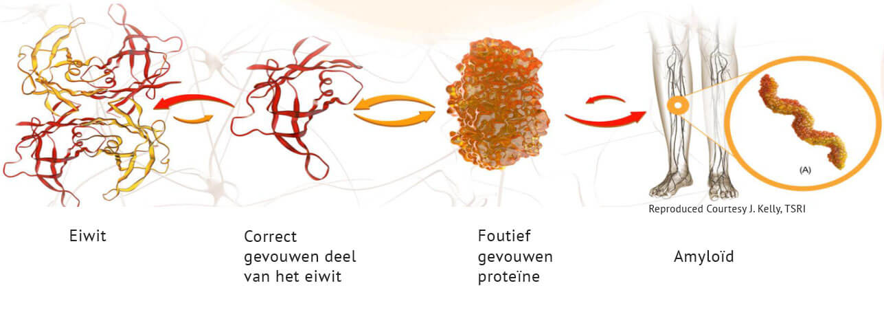 Onjuiste eiwitvouwing