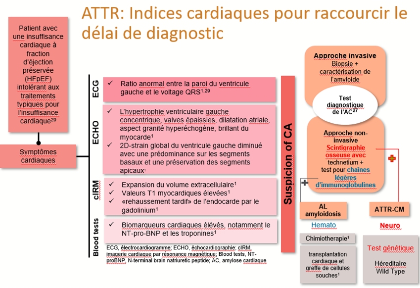 les indices cardiaques pour raccourcir le délai de diagnostic 