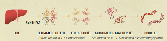 Structures de la TTR associées à la cardiomyopathie. La TTR est une protéine naturelle qui peut devenir instable