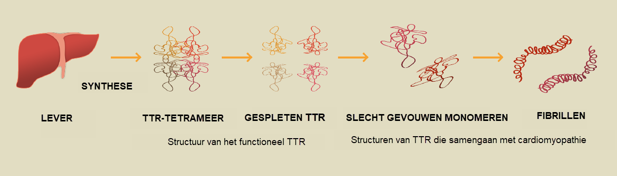 TTR is een natuurlijk eiwit dat onstabiel kan worden. Structuren van TTR die samengaan met cardiomyopathie