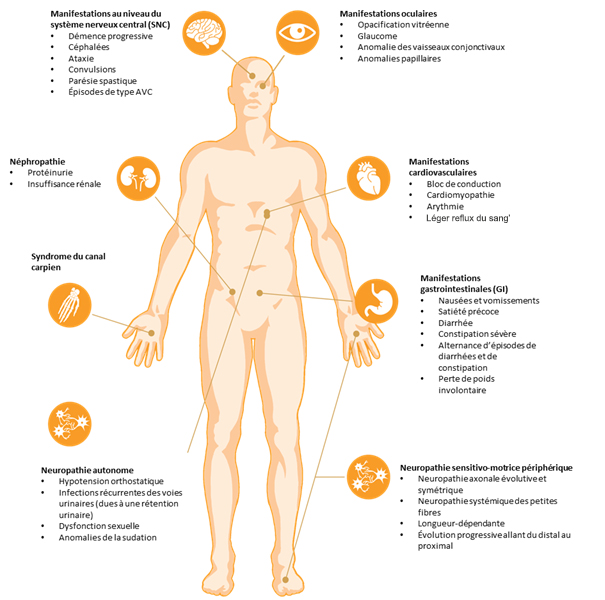 Les principaux indicateurs d'alerte pour l'amylose et l'amylose hATTR